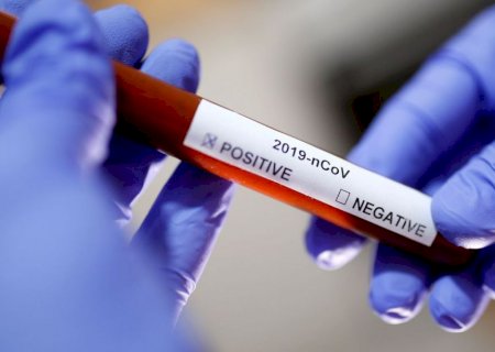 Mais três pacientes são curados do novo coronavírus em MS