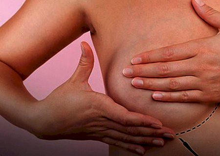 Femama alerta sobre mamografias após vacina contra Covid-19