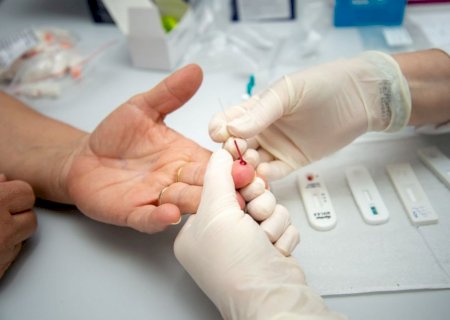 Governo Federal anuncia distribuição de 28,2 milhões testes para covid-19 em janeiro