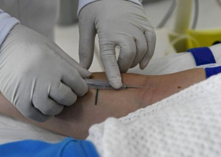 Sem registros há 7 anos, Mato Grosso do Sul intensifica monitoramento contra a hantavirose